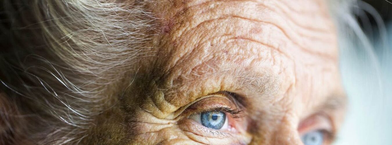 Abused caucasian senior woman with black eye
