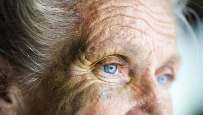Abused caucasian senior woman with black eye