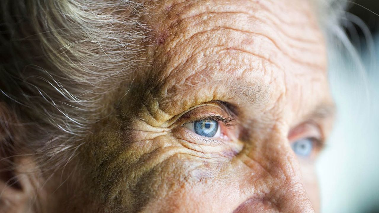 Abused caucasian senior woman with black eye